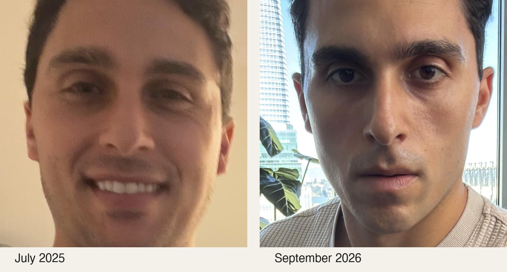 Side-by-side photos of Nick's face: puffy and swollen in July 2025, leaner with a defined jaw in September 2026