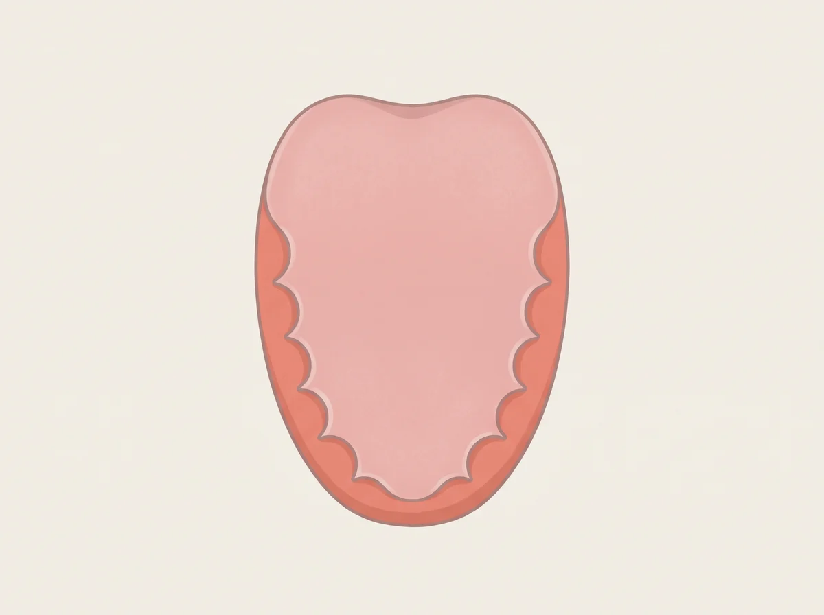 Illustration of wavy tooth marks along the tongue edges. The sides of the tongue have a wavy, rippled edge where the tongue has pressed against the teeth. It is easiest to see when you stick your tongue out in a mirror.